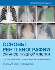 обложка Основы рентгенографии органов грудной клетки от интернет-магазина Книгамир