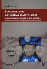 обложка Восстановление контактных областей зубов с помощью матричных систем. 2-е изд., + CD от интернет-магазина Книгамир