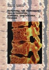 обложка Переломы тел позвонков при остеопорозе. Клиника, диагностика, лечение от интернет-магазина Книгамир