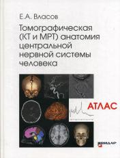 обложка Томографическая (КТ и МРТ) анатомия центральной нервной системы человека (Атлас) от интернет-магазина Книгамир