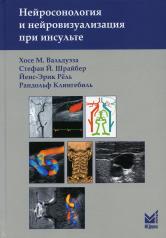 обложка Нейросонология и нейровизуализация при инсульте. 2-е изд от интернет-магазина Книгамир