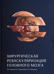 обложка Хирургическая реваскуляризация головного мозга от интернет-магазина Книгамир